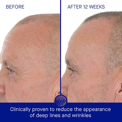 Image 3 - Side-by-side comparison of a mans profile showing skin before and after 12 weeks of treatment, with visible text stating BEFORE on the left and AFTER 12 WEEKS on the right, and additional text below reading Clinically proven to reduce the appearance of deep lines and wrinkles.
              Image 4 - A blue serum bottle with a gold cap is displayed prominently, accompanied by text highlighting clinically proven results: Post-acne marks are visibly reduced by 90%, skin texture is improved by 68%, and the appearance of deep lines and wrinkles is reduced by 56%, with a small note about a 12-week clinical trial at the bottom.
              Image 5 - Image shows two bottles of skincare serum with a blue and gold design against a light background, featuring text that states: User Proven Results, 97% agree the appearance of deep wrinkles and fine lines is reduced, 100% agree skin looks lifted, tighter and firmer, 98% agree skin looks and feels more smooth, clear and refined, with a note about a 12-week clinical trial.
              Image 6 - Image of a blue and gold serum bottle labeled The Retinol Serum with TFC8® against a gradient background, with text describing the benefits of TFC8®, Marine Ectoine, Pure Retinol, and Microbiome Blend. Visible text includes details about each ingredients purpose for skin renewal and care.
              Image 7 - Image shows a step-by-step guide for applying a skincare product, with a person in three images: Step 1 dispenses two pumps into hands, Step 2 smooths the product over the face, neck, and décolletage, and Step 3 shows an application of moisturizer, with text reading AB Insider Tip Apply at night and wear sunscreen during the day.
              Image 8 - Image shows two skincare products side by side: The Serum on the left with an orange bottle and a blue background, and The Retinol Serum on the right in a blue bottle with a white background, both featuring their textures, key benefits, key concerns, and ideal skin types listed below.
              Image 9 - A skincare routine for oily skin, featuring four products: 1. Cleanse - The Foaming Cleanser, 2. Smooth & Refine - The Retinol Serum, 3. Hydrate & Renew - The Ultimate Soothing Cream, and 4. Revitalize & Refresh - The Eye Cream.
              Image 10 - Two blue bottles of Augustinus Bader skincare serums are displayed side by side on a reflective surface, one larger bottle labeled 30 ml and the smaller one labeled 15 ml, both featuring gold caps and the text THE RETINOL SERUM WITH TFC8®.