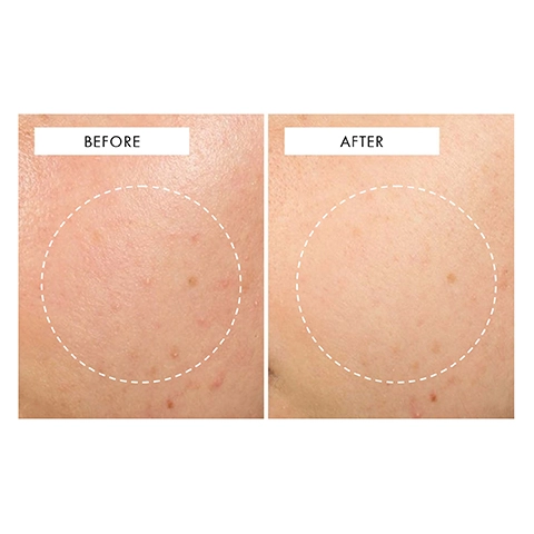 before and after