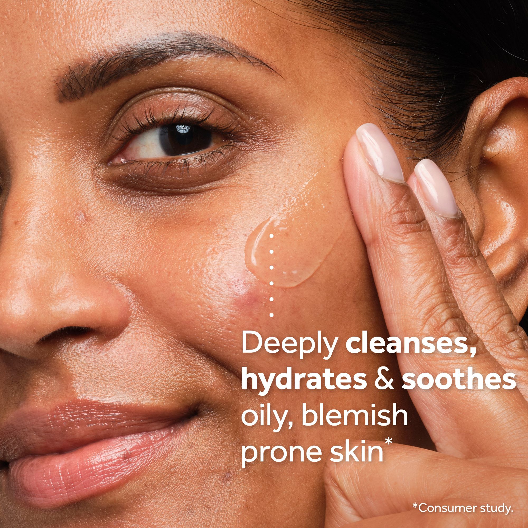 A person applies a clear gel with white dots to their cheek, which has a blemish, with the text Deeply cleanses, hydrates & soothes oily, blemish prone skin* *Consumer study.