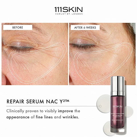Image 1 - The image shows a side-by-side comparison of a persons eye area labeled Before and After 6 weeks with visible improvements in skin texture, alongside a product bottle of 111SKIN Repair Serum NAC Y2™ and the text Clinically proven to visibly improve the appearance of fine lines and wrinkles.
              Image 2 - Image shows a side-by-side comparison of an eye area with a marked outline; the left image labeled Before shows prominent fine lines, while the right image labeled After 6 Weeks displays a smoother appearance, with a product bottle for EYE LIFT GEL NAC Y²™ featuring the text Clinically proven to visibly improve the appearance of fine lines around the eyes.