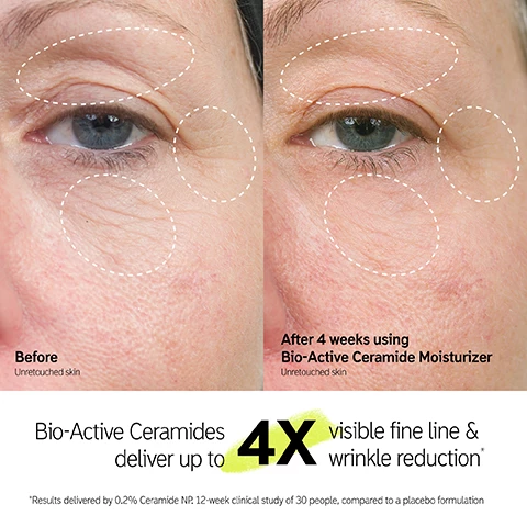 Image 1, before and after 4 weeks using bio-active ceramide moisturiser. bio active ceramides deliver up to 4 times visible fine lines and wrinkle reduction. results delivered by 0.2% ceramide NP 12 week clinical study of 30 people compared to a placebo formulation. image 2, bio active ceramides deliver up to 4 times visible fine line and wrinkle reduction. firm, plump and visibly lift. rich, velvety formula. results delivered by 0.2% ceramide NP 12 week clinical study of 30 people compared to a placebo formulation. image 3, 0.2$ bio-active ceramide NP visibly smooths, firms and helps strengthen skin's moisture barrier. 5% gransil blur x-11, instantly blurs the appearance of fine lines