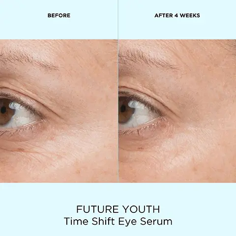 Image 1, before and after 4 weeks future youth time shift eye serum, Image 2, before and after 4 weeks future youth gravity rebound serum, Image 3, before and after 4 weeks future youth gravity rebound serum