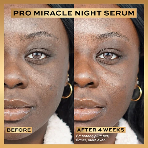 Image 1 - Image shows a side-by-side comparison of a womans face, with the left side labeled BEFORE showing skin with visible texture and uneven tone, and the right side labeled AFTER 4 WEEKS showing smoother and more even-toned skin, with visible text stating Smoother, plumper, firmer, more even! at the bottom.
              Image 2 - A split image shows a young woman’s face in profile, with the left side labeled BEFORE displaying some blemishes and a matte appearance, and the right side labeled AFTER 4 WEEKS showing a smoother and shinier complexion; additional text reads Smoother, plumper, firmer, more even!
              Image 3 - A hand holding a bottle of Revolution Pro Miracle Night Serum against a soft background, with text highlighting user agreement percentages on skin improvements, including plumper, smoother, and firmer skin.