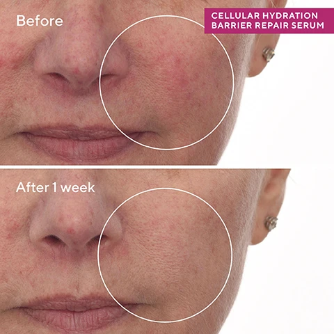 Image 1, before and after 1 week. image 2, in one use visibly smoothes texture for improved overall complexion. in 30 minutes repairs skin barrier to deliver hydration at the cellular level. in 1 week visible reduced redness to tame aggrevated skin. image 3, murad ingredients plus. biomimetic hexapeptide-9 = restores damaged skin and reduces water loss. network of hyaluronic acid molecules = protects and hydrates. handpicked bilberries = support a healthier barrier with omegas 3 and 6. image 4, your skin barrier repair regime. treats at a cellular level. 1 = soothing oat peptide cleanser - cleanse, rinse and pat dry. 2 = cellular hydration repair serum - apply an even later of serum onto clean skin. 3 = cellular hydration repair cream - massage cream evenly over face, neck and chest. apply SPF in the morning. 4 = celluar hydration repair mask - on nights your skin needs extra hydration, massage mask over face and neck, do not rinse until the morning.