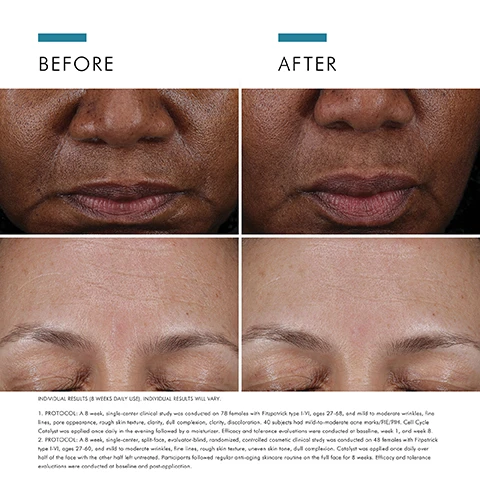Image 1 - Before and after images showing close-up views of womens faces, with noticeable improvements in skin texture and appearance after treatment; visible text includes BEFORE and AFTER at the top, along with detailed text below describing the studys protocol and results.
              Image 2 - An image of a clear serum dropper with droplets of serum in a petri dish, accompanied by text describing key ingredients: 7.7% MULTI-ACIDS - Multi-layer action to gently peel and enhance skin renewal cycles for smoother texture, reduced visible discolouration and improved appearance of fine lines; 1% TAURINE - A high concentration of an amino acid (naturally found in skin).
              Image 3 - A close-up of a woman with brown skin and dark hair applying a dropper of serum to her cheek, with visible text that reads accelerates cell turnover and boosts anti-ageing routine results.
              Image 4 - The image shows a white background with various glossy, clear serum drops and circles, accompanied by text that reads: AT A GLANCE, TEXTURE, Lightweight serum texture, SKIN TYPE, Ageing, Normal, Combination, Dry, Oily.
              Image 5 - Black and white image of a woman with long dark hair wearing a blazer, smiling slightly, accompanied by a quote about a skincare product attributed to Dr. Ana Mansouri, Aesthetic Doctor at Dr Ana The Skin Clinic in Birmingham.
              Image 6 - A close-up image of a woman applying a serum to her face, with step-by-step instructions on the left side reading: HOW TO APPLY, STEP 1: Once daily after cleansing, apply 1/3 of a dropper amount with a cotton pad or clean hands to a dry face, STEP 2: Use before a SkinCeuticals antioxidant and moisturiser. In the morning, follow with a broad-spectrum sunscreen.
              Image 7 - Image shows a skincare routine with four labeled steps, each featuring a product: Step 1 is CELL CYCLE CATALYST, Step 2 is C E FERULIC®, Step 3 is A.G.E. INTERRUPTER ADVANCED, and Step 4 is ADVANCED BRIGHTENING UV DEFENSE SUNSCREEN SPF 50.
