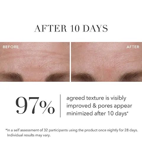 Image 1, BEFORE AFTER 10 DAYS AFTER 97% agreed texture is visibly improved & pores appear minimized after 10 days* *In a self assessment of 32 participants using the product once nightly for 28 days. Individual results may vary. Image 2, EN NICRCIALCAL ALGENIST Clinically proven to reduce the appearance of deep lines & wrinkles in 10 days* *In a clinical sproventudy of 32 participants using the product once nightly for 28 days. Individual results may vary. Image 3, ALGURONIC ACID hydrates & visibly reduces lines & wrinkles GREEN MICROALGAE & RETINOL visibly reduce deep wrinkles & help firm skin AHA+BHA+PHA help improve resurfacing & retinol delivery GREEN MICROALGAE RETINOL+ Regenerating Serum Sérum Régénérat ALGENIST Image 4, Visibly improves firmness while plumping skin Visibly brightens skin, minimizes fine lines & wrinkles GENIUS Liquid Collage Collage GENIUS GREEN MICROALGA RETINO Sinum Rigindus ALGENIST ALGENIST ALGENIST Visibly reduces deep lines & wrinkles, without causing irritation Image 5, INNOVATIVE INGREDIENTS PATENTED ALGURONIC ACID to smooth lines & wrinkles ALGENIST RETINOID-LIKE GREEN MICROALGAE & RETINOL time-released to reduce deep wrinkles RETINOL+ GREEN MICROALGAE Regenerating Ser AHA + BHA + PHA to accelerate resurfacing & improve retinol delivery GREEN Sérum Régénérat Regenerating Sen BISABOLOL to soothe skin