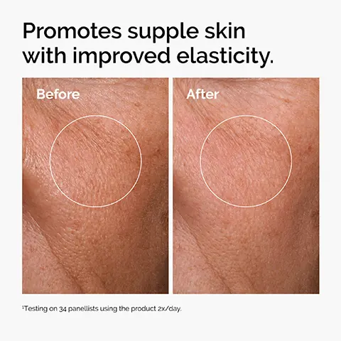 Image 1 - Image showing a side-by-side comparison of skin texture with a labeled Before on the left and After on the right, highlighting text that reads promotes supple skin with improved elasticity.
              Image 2 - Image shows three skincare products from The Ordinary arranged horizontally: a Squalane Cleanser labeled Cleanse skin and remove makeup, a Hyaluronic Acid 2% + B5 labeled Hydrate and plump the skin, and Natural Moisturizing Factors + HA labeled Supports the skin barrier, with the heading Build Your Regimen: above the products.
              Image 3 - A bottle of The Ordinary Hyaluronic Acid serum with a dropper lid, featuring a white label with black text that includes the product name, ingredient information, and the note *1 Serum Brand in the UK.