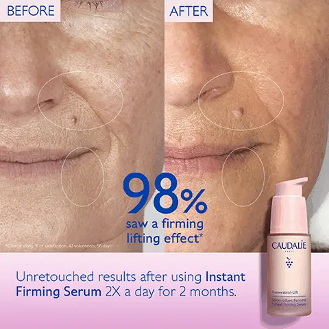 Image 1, BEFORE AFTER Cinical dy% of faction, 42 volunteers, 56 days 98% saw a firming lifting effect* Unretouched results after using Instant Firming Serum 2X a day for 2 months. CAUDALIE Resertral-U Sérum Lifts Fernet tant Firming Se Image 2, CAUDALI Resver 98% saw a firming lifting effect* *Cinical study of satisfaction, 42 volunteers, 56 days
