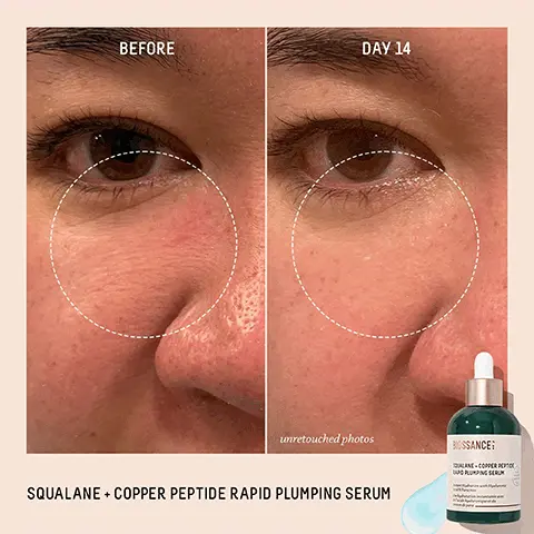 Squalane + Copper Peptide Rapid Plumping Serum, Before vs. Day 14, unretouched photos. Squalane +Copper Peptide Rapid Plumping Serum, Before vs. Day 28, unretouched photos. Immediately 100% showed an instant boost of hydration in skin, after 1 week 97% noticed a visible improvement in skin firmness & elasticity, after 4 weeks 100% demonstrated a reduction in fine lines & wrinkles, based on a 28 day clinical study of 33 female subjects, ages 35-60, after twice daily use, based on a 28 day consumer study of 33 female subjects, ages 35-60, after twice daily use.