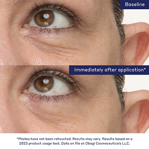 Image 1 to 4, baseline and immediately after application. photos have not been retouched. results may vary. results based on a 2023 product usage test. datae on file at obagi cosmeceuticals LLC