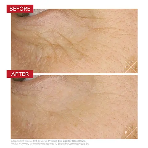 Image 1, BEFORE dr P AFTER Independent clinical test, 8 weeks. Product: Eye Booster Concentrate. Results may vary with different patients. O Scientific Cosmeceuticals SA dr P L Image 2, ﻿ Dr. LEVY SWITZERLAND на на на на на на на на на на нЖ нннннн INTENSE STEM CELL Eye Booster Concentrate Concentré Activateur Contour des Yeux Just as many opportunities to enhance your gaze Coulon 002 Депк
