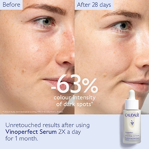 Image 1, before and after 28 days. -63% colour intensity of dark spots. unretouched results after vinoperfect serum twice a day for 1 month. clinical study, dermatologisy scoring, 91% of 65 volunteers, 28 days. image 2, clinically proven results. -81% colour intensity of dark spots on dark skin after 1 bottle. clinical study, dermatologist scoring on dark spot coloration, on 65 volunteers after 56 days. image 3, all types of dark spots = sun, acne, age and pregnancy. all skin types = dermatologically tested, non photosensitising. image 4, viniferine - 62 times more effective than vitamin c = corrects and prevents dark spots. olive squalane = moisturises and soothes. image , brightening glycolic essence, brightening micropeel foam, brightening eye cream, brightening dark spot serum, instant brightening moisturiser, glycolic night cream