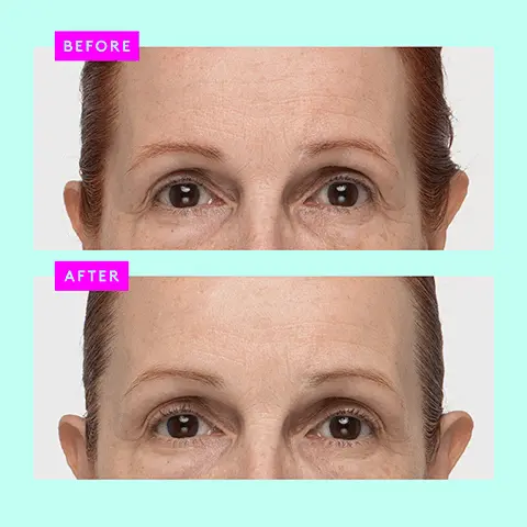 Image 1, BEFORE AFTER Image 2, 96% showed improvement in skin's tone, radiance, and luminosity' 93% showed improvement in texture* 90% showed improvement in skin's hydration' *In a consumer-perception study with 32 people after 8 weeks of use Protini Polypeptide Cream Crème aux polypeptides STRENGTHEN MOISTURIZE 50 Image 3, signal peptide complex binds moisture to skin plumping firming and restoring bounce pygmy waterlily stem cell extract source of antioxidants and nutrients to replenish the skin soybean folic acid ferment extract plays a central role in maintaining youthful elastic skin