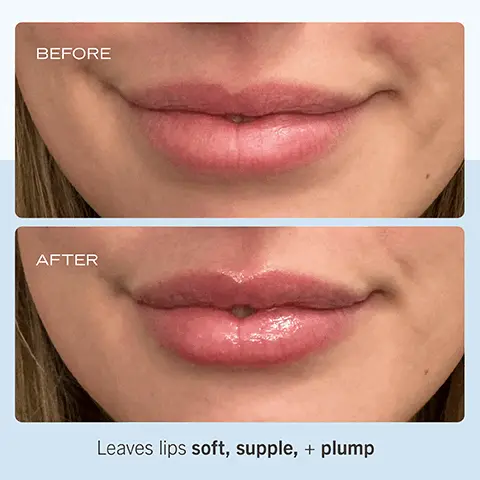 Image 1, ﻿ BEFORE AFTER Leaves lips soft, supple, + plump Image 2, ﻿ Instantly hydrates with a subtle sheen TRAREPAIRUP BAUME LEVE ULTRAREPARAT NET WT6025 Image 3, ﻿ Butters Concentrated formula Waxes locks in moisture to Botanical Oils nourish distressed lips Image 4, ﻿ BAUME A LEVRES ULTRA RÉPARATEUR NETWT. 69 (0.25 02) o Rich, Buttery Texture o Cruelty-Free o Free of Fragrance, Flavor + Color ULTRA REPAIR LIP BALM BAUME À LÈVRES ULTRA RÉPARATEUR NET WT. 69 (0.250Z) ULTRA REPAIR LIP BALM ULTRA REPAIR LIP BALM NET WT. 6 g (0.25 02) ULTRA RÉPARATEUR BAUME À LÈVRES