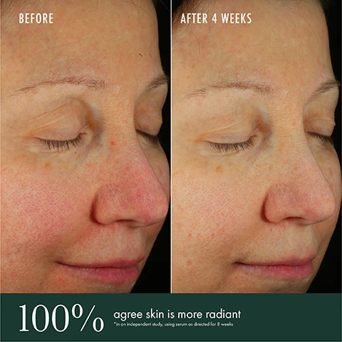 Image 1, before and after 4 weeks. 100% agree skin is more radiant. in an independent study, using serum as directed for 8 weeks. image 2, before and after 4 weeks. 97$ showed a visible reduction in lines and wrinkles. in an independent study, using serum as directed for 8 weeks.