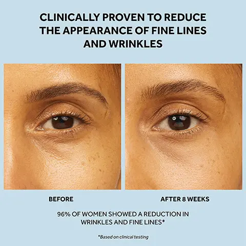 Clinically proven to reduce the appearance of fine lines and wrinkles. Before, After 8 weeks. 96% of woman showed a reduction in wrinkles and fine lines. *Based on clinical testing. Skin feels smoother & firmer after 1 week, fine lines and wrinkles appear visibly reduced after 2 weeks. Kick start your regime with protect & perfect, 1. serum, 2. eye cream, 3. day cream night cream.