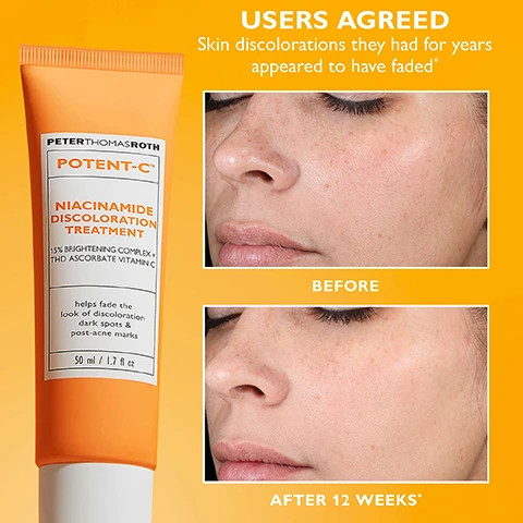Image 1, users agreed skin discolorations they had for years appeared to have faded. before and after 12 weeks. image 2, 15% brightening complex - with niacinamide, tranexamic acid, kojic acid, alpha arbutin and pentapeptide. THD ascorbate vitamin c advanced form of vitamin c that boosts brightening results. image 3, done with dark spots? say goodbye with niacinamide and potent vitamin c