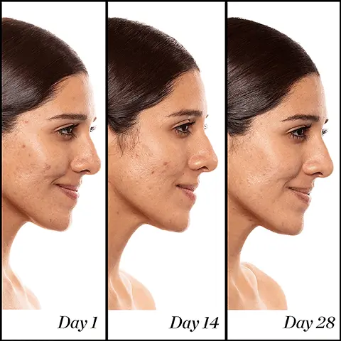 Image 1, day 1, day 14, day 28 Image 2, Day 1 Day 42 Image 3, clinically proven to visibly reduce the appearance of pores and fine lines image 4, 6.3% Retimidead, CoQia Honey A+ HIGH-DOSE RETINOID SERUM Advanced-strengenderm dev15 power blend of abled refroids and rende botanical extract into the skin SUNDAY RILEY 15ml "This pro-strength formula is designed for those who want serious results without serious downtime." Sunday Riley CEO+Brand Founder Image 5, COQ10 helps improve the appearance of aging or damaged skin, for a healthier-looking balanced complexion Hawaiian White Honey is rich in phytonutrients + soothes the skin for a calmer, even-toned complexion 5% Retinoid Ester Blend +1% Retinol Blend help reduce the appearance of wrinkles and fine lines + help the signs of clearer skin Advance-strength retinoid serum delivers stabilized retinoid blends + botanicals into the skin Image 6, P GOOD GENES OLYCOLICADO C.E.O. SUNDAY RILEY A+ HOW-DOSE RETHOD SEROM SUNDAY RILEY SUNDAY RILEY Boost GLOW + RADIANCE with our trio of best-selling, highly effective serums