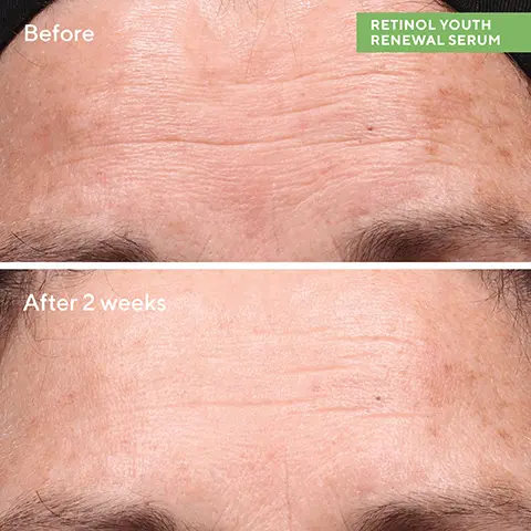 Before, After 2 weeks. RETINOL YOUTH, RENEWAL SERUM. After 2 Weeks, Clinically tested to visibly improve signs of skin ageing, Visibly firms skin 92% saw smoother skin. After 4 Weeks, 99% agreed it was gentle enough for nightly use. Proven results reported by 56 trial participants. ages 35-65, in an 8-week clinical study. Wrinkles Don't Stand a Chance. CLEANSE 01 Renewing Cleansing Cream. 02 TARGET Retinol Youth Renewal Serum. 03 MOISTURISE + RENEW Retinol Youth Renewal Night Cream
