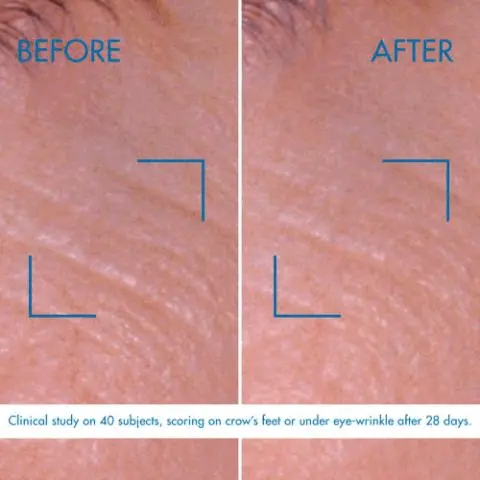 Image GIF1 - A before and after comparison showing a close-up of skin around the eye, with the left panel displaying more pronounced crows feet wrinkles and the right panel showing a noticeable reduction in wrinkles, both areas highlighted by blue L-shaped markers. Text on the image reads: BEFORE, AFTER, Clinical study on 40 subjects, scoring on crows feet or under eye-wrinkle after 28 days. Image GIF2 - An abstract image features a cluster of blue and teal gel-like bubbles and fluid shapes against a vibrant blue background, with text below that reads: LIFE PLANKTON IS COMBINED WITH PRO-RETINOL WHICH BOOSTS SKIN CELL REGENERATION AND HAS A RESURFACING ACTION TO CORRECT WRINKLES AND SKIN TEXTURE.
