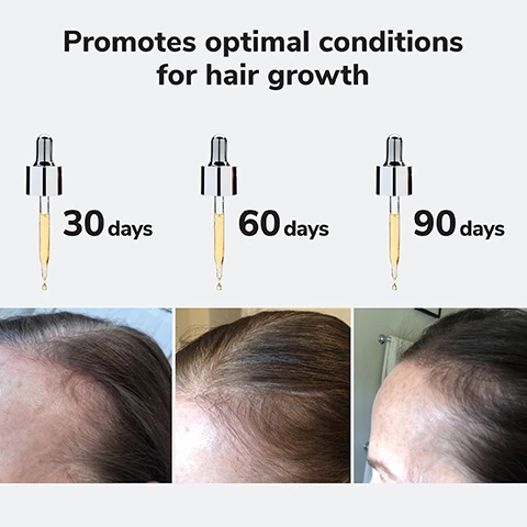 Image 3 - Image shows a graphic with three dropper bottles labeled 30 days, 60 days, and 90 days on top, along with side-by-side images of hair growth over the same time periods, with the text promoting optimal conditions for hair growth.
              Image 4 - Image of a golden orb with text stating clinically proven to reduce shedding by up to 90% and an asterisk noted below for a study reference.
              Image 5 - A close-up image of a iridescent serum bottle labeled COLOR WOW with text on the right stating ABSORBS INSTANTLY NO GREASY FEEL and icons indicating NO SILICONES, NO ALCOHOL, NO OILS, NO ADDED FRAGRANCE, VEGAN.
              Image 6 - A dropper bottle with a black cap and yellow liquid sits on a reflective surface, accompanied by two circular puddles of the same liquid, with text that reads PROCAPIL® strengthens root-grip to reduce shedding and SYNTHETIC COLLAGEN moisturizes and mimics natural collagen.
              Image 8 - An image of a glass bottle labeled YOUTH JUICE Collagen Scalp Treatment with a dropper, containing a golden liquid, and text stating Creates optimal conditions for hair growth + stronger, thicker, more resilient hair. Below the main label is COLOR WOW and additional text in French.
              Image 9 - A person with long, wet hair is applying a dropper of hair treatment directly to their scalp, focusing on the hairline, with text on the side outlining usage instructions.