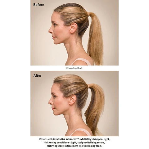 Image 1, 2 and 3, before on unwashed hair, after. results with invati ultra advanced exfoliating shampoo light, thickening conditioner light, scalp revitalising serum, fortifying leave in treatment and thickening foam. image 4, feel the power of thicker, fuller hair.