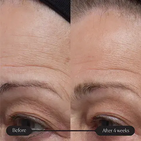 Image 1 and 2, before and after 4 weeks. image 3, before and after 5 days Image 4, ELEMIS PRO-COLLAGEN FUTURE RESTORE SERUM Advanced firming complex Complexe raffermissant avancé World-First Opal Skin Algae Complex A blend of three single-celled marine algae — - including one exclusively discovered by ELEMIS in an intelligent delivery system Padina Pavonica Ferment A fermented algae known for its antioxidant, firming & hydrating benefits Marine Bacillus Ferment Energises cells & promotes protein synthesis for a firmer appearance Marine Cellular Lipids Extreme-environment microalgae, known to nourish & condition the skin Image 5, Powerful Results Clinically proven to increase firmness by up to 46% in just 4 days.* 96% agreed this product made their skin look fuller and more voluminous. Clinically proven to visibly reduce fine lines and wrinkles^ in 4 days.* ELEMIS PRO-COLLAGEN FUTURE RESTORE SERUM nced firming Comp avancé fermissant 97% agreed this product left their skin more radiant. *Independent Clinical Trials 2024, 30 people over 4 weeks. Independent User Trials 2023, based on 118 people over 4 weeks. ^Refers to forehead wrinkles.