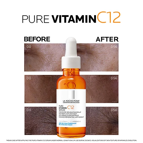 Image 1 - Image shows a side-by-side comparison of skin before and after using a serum, with an orange dropper bottle labeled LA ROCHE-POSAY PURE VITAMIN C12 SERUM positioned in the center, along with the text BEFORE and AFTER; visual notes indicate changes in skin texture and wrinkles over 56 days.
              Image 2 - Image of a dropper bottle containing an orange serum, with text that says BOOST SKIN RADIANCE REDUCES THE APPEARANCE OF WRINKLES.
              Image 3 - A brown serum bottle with a dropper cap is shown, next to bold text stating new formula now with 12% pure vitamin C, 93% of women see an improvement in radiance, and 71% of women see an improvement of skin tone evenness.
              Image 4 - A hand gently touches the dropper of a brown serum bottle labeled La Roche-Posay Pure Vitamin C12 Serum, with the text APPLY IN THE MORNING AND NIGHT TO THE FACE prominently displayed.
              Image 5 - An orange bottle of La Roche-Posay Pure Vitamin C12 Serum is displayed against a background of various skin tones, with text stating PURE VITAMIN C12 SERUM FOR ALL SKIN TONES.
              Image 6 - A triptych showcasing three skincare ingredients with abstract textures: the first panel features multicolored patterns labeled Pure Vit. C, the second panel displays crystalline structures labeled Salicylic Acid, and the third panel contains blue droplets labeled Neuro Sensine, with descriptive text about their benefits.
              Image 7 - Image shows two skincare products from La Roche-Posay: an orange bottle of Pure Vitamin C12 Serum on the left with text that reads BOOSTS SKIN RADIANCE REDUCES THE APPEARANCE OF WRINKLES, and a white bottle of Anthelios UVMUNE 400 Daily Sun Protection on the right with text stating THE MOST EFFICIENT UV FILTER VERY HIGH UVB AND ULTRA LONG UVA DAILY SUN PROTECTION FOR FACE.
              Image 8 - Image shows two skincare products from La Roche-Posay: a dropper bottle of Pure Vitamin C12 Serum on the left and a tube of Anthelios UVMune 400 sunscreen on the right, with instructions: 1 APPLY 3-4 DROPS ON FACE AND NECK AFTER CLEANSING, 2 APPLY TO FACE AND NECK REAPPLY EVERY 2H.