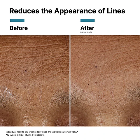 Image 1 - Image showing a side-by-side comparison of skin labeled Before on the left and After on the right, highlighting the reduced appearance of lines; visible text includes Reduces the Appearance of Lines and notes on individual results from a clinical study.
              Image 2 - Image shows a glass petri dish with pink droplets indicating different skincare ingredients, accompanied by a dropper and labeled text listing KEY INGREDIENTS, 1.3% Hyaluronic Acid, 12% Proxylane™, 2% Post-Biotic Ferment Extract, and 2.0% Licorice Root Extract (Dipotassium Glycyrrhizate).
              Image 3 - Image shows a close-up of pink serum-gel blobs with the text AT A GLANCE followed by Texture: Lightweight, serum-gel texture and Skin Type: • Normal • Oily • Dry • Combination • Sensitive.
              Image 4 - A dark purple bottle of SkinCeuticals HA Intensifier Multi-Glycan serum is positioned next to a clear glass vial, with a dropper above the serum bottle; visible text includes INTEGRATED SKINCARE, Visibly Plumps + Contours Skin, Suitable for use in between injectable treatments, and HA Intensifier Multi-Glycan is a cosmetic treatment, always consult a Medical Professional.
              Image 5 - A woman holds a dropper above her hand with a purple liquid, and the image includes text that states HOW TO APPLY, Step 1: Twice daily, after applying an antioxidant serum, dispense 4-6 drops into clean hands, and Step 2: Gently press evenly into skin. Follow with a moisturiser and sunscreen.
              Image 6 - Image of a skincare routine guide featuring four products arranged from left to right, labeled as Step 1: Prevent with C E Ferulic, Step 2: Correct with HA Intensifier Multi-Glycan, Step 3: Correct with Triple Lipid Restore 2:4:2, and Step 4: Protect with Advanced Brightening UV Defense SPF 50, along with the heading COMPLETE THE MORNING ROUTINE.
              Image 7 - Image showing a skincare nighttime routine with four product bottles labeled as step 1, step 2, step 3, and step 4, featuring Resveratrol B E, HA Intensifier Multi-Glycan, A.G.E Advanced Eye, and Triple Lipid Restore 2:4:2. Text at the top reads COMPLETE THE NIGHTTIME ROUTINE.