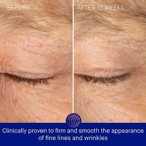 Image 3 - Image shows a close-up comparison of eyelids labeled Before on the left and After 12 Weeks on the right, with visible improvement in skin smoothness, and text at the bottom stating Clinically proven to firm and smooth the appearance of fine lines and wrinkles.
              Image 4 - A blue jar of Augustinus Baders Rich Eye Cream with a gold lid is displayed against a soft background, accompanied by text highlighting clinically proven results: skin hydration improved by 2x, fine lines and wrinkles reduced by 25%, and eye puffiness reduced by 46%, with a note about a 4-week clinical trial.
              Image 5 - A close-up of a woman gently touching her under-eye area, with text stating that 95% agree the eye area appears visibly lifted and firmer, 90% agree the appearance of fine lines and wrinkles is diminished, and 91% agree under-eye bags appear reduced, along with a note about a consumer perception study.
              Image 6 - Image of a blue jar of Augustinus Baders The Rich Eye Cream with a copper-colored lid, surrounded by descriptions of ingredients and their benefits: TFC8, Wild Yellow Gentian Root Extract, Matrikine Anti-Wrinkle Complex, and Reishi Extract.
              Image 7 - Image shows a woman demonstrating an eye care routine with three steps outlined, including visible text: Step 1 Dab a small amount under the eye and on the upper lid, working outwards Step 2 Softly tap around the eye in a circular movement Step 3 Use the applicator to swipe from the inner corner outward AB Insider Tip Store The Applicator in the refrigerator for a cooling effect to help de-puff and support microcirculation.
              Image 8 - Image shows two different eye creams side by side on a blue background: on the left, a bottle labeled The Eye Cream with descriptors for texture, key benefits, key concerns, and ideal skin type, and on the right, a jar labeled The Rich Eye Cream with similar descriptors.