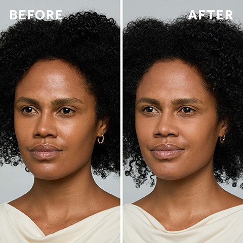 Before, After
