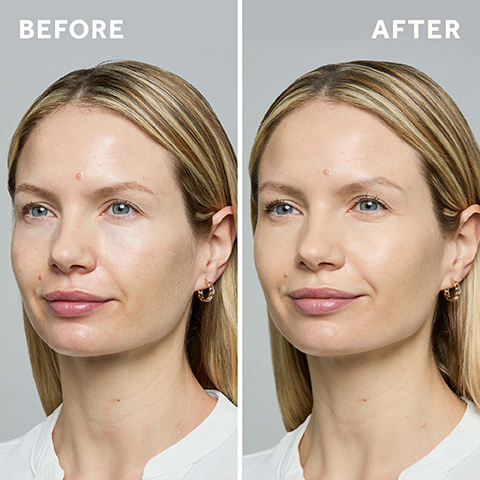 Before, After
