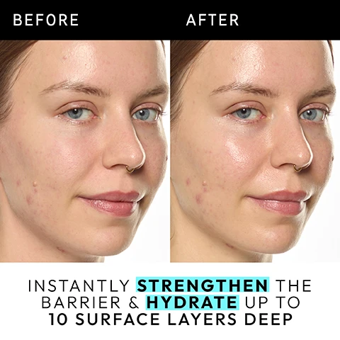 Image 1 - Image shows a side-by-side comparison of a womans face before and after treatment, with visible skin improvements and the text INSTANTLY STRENGTHEN THE BARRIER & HYDRATE UP TO 10 SURFACE LAYERS DEEP.
              Image 2 - A close-up image of a woman applying a skincare product to her face, accompanied by text that states HYDRATION + BARRIER and three claims: Deeply hydrates up to 10 surface layers deep*, Strengthens the skins barrier in 15 minutes*, and Visibly restores bounce in 3 days*.
              Image 3 - Close-up of a persons face with a skincare product applied alongside text stating Clinically proven to visibly improve 5 signs of a compromised skin barrier*, featuring the words DRYNESS, DULLNESS, REDNESS, SLACKNESS, and TEXTURE with asterisks indicating a reference to a clinical study.
              Image 4 - An infographic titled The ingredient science displays a Venn diagram with three overlapping circles, indicating components for ultimate healthy skin; the circles list 2% Ectoin with the note Deeply hydrates & strengthens the barrier, 2.5% Multi-Molecular Hyaluronic Acid stating Helps deliver multi-level hydration within the skins surface, and 1% Barrier Blend described as With 3 Ceramides to help protect the skins barrier.
              Image 5 - Image shows two skincare products side by side labeled with Hydrate your way at the top, featuring a pump bottle of Hydro Barrier Serum on the left with text describing its benefits, and a dropper bottle of Hyaluronic Acid Serum on the right with its own set of benefits. Visible text includes BOOST YOUR HYDRATION BUILD YOUR BARRIER with bullet points for benefits like strengthens & supports the barrier, deeply hydrates, and lightweight, milky texture, and DAILY HYDRATION ESSENTIAL with bullet points like daily essential for dehydrated skin, plumps & hydrates, and lightweight, non-tacky gel texture, with vs in the center.
              Image 6 - An abstract white background with a creamy texture at the top, overlayed with the text How to layer your routine and numbered steps for a skincare routine: 1 Clean, 2 Hydrate, 3 Treat, 4 Moisturize, 5 SPF, with Hydrate highlighted in blue.
              Image 7 - A close-up image of a woman with glowy skin resting her chin on her hand, accompanied by text that reads When & how to apply with symbols for AM, PM, and a pea-sized amount.