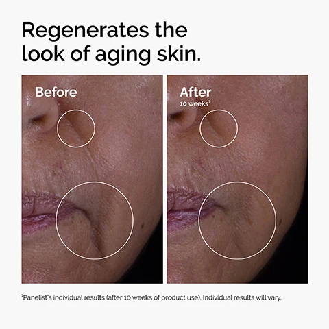 Image 1 - Image comparing the appearance of skin before and after treatment, showing prominent wrinkles and texture changes; visible text includes Regenerates the look of aging skin, Before, and After 10 weeks.
              Image 2 - Image of a clear product with bubbles, accompanied by three icons and text stating Repairs Visible Skin Damage, Minimizes the Look of Fine Lines and Wrinkles, and Prevents the Look of Aging Skin.
              Image 3 - Image showing a white background with bubbles and the text highlighting key ingredients in GF 15% Solution, listing three growth factors: TGF helps reduce lines and wrinkles, EGF promotes elasticity and firmness, IGF supports skin density and collagen production.