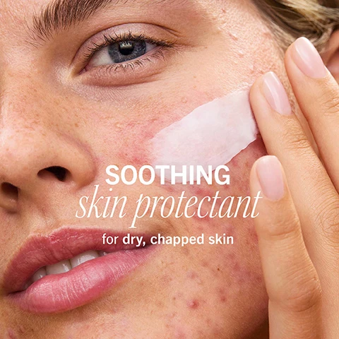 Image 1 - A close-up of a persons face applying a cream to their cheek, with visible text that says SOOTHING skin protectant for dry, chapped skin.
              Image 2 - Close-up of a tube opening with white cream at the tip, with text that reads Formulated with 1% Dimethicone for instant skin relief.
              Image 3 - A young woman with freckles and acne applies cream to her cheek, smiling softly, with the text soothes IRRITATION from prescription-strength acne + retinoid treatments visible in the image.
              Image 4 - A hand holds a dollop of creamy white substance being squeezed from a metal tube, with the words rich + luxurious yet breathable formula prominently displayed in red text.
              Image 5 - A close-up of a persons eye showcases the skin around the eye before and after treatment, with visible improvements, labeled as BEFORE on the left and IMMEDIATELY AFTER on the right, with the text STRENGTHENS damaged skin barrier above.
              Image 6 - A blue tube of cream with the text Colloidal Oatmeal and the statement Improves skin surface renewal 2x faster* is shown, with white cream squeezed out from the tubes opening.
              Image 7 - A smiling person with a light skin tone has cream applied to their face, with visible text stating non-comedogenic + wont clog pores.
              Image 8 - Two tubes of First Aid Beauty Ultra Repair Rescue Barrier Balm on a white background, one labeled as travel size and the other as full size, with a small amount of cream displayed beside them.
              Image 9 - Image shows two moisturizer products, the first is a white jar labeled Ultra Repair Cream with text indicating use for daily hydration, and the second is a blue tube labeled Ultra Repair Rescue Barrier Balm for emergency use, with visible text describing its benefits for dry, sensitive skin.