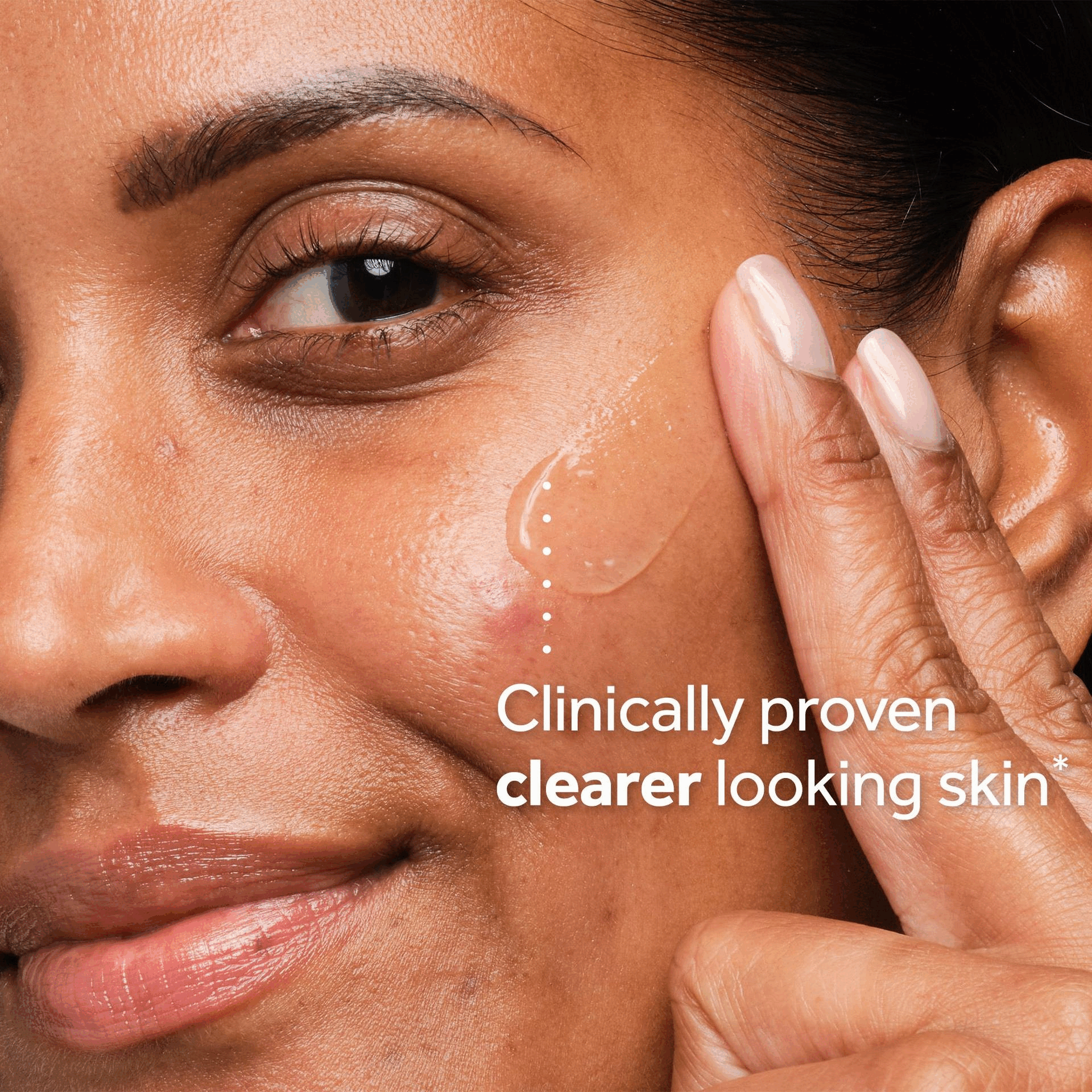 Image 1 - A close up of a person applying serum to their cheek Clinically proven clearer looking skin*. Image 2 - A bottle of No7 Dermo Solutions Oily & Blemish Prone Skin AHA Smoothing Treatment is displayed on a green background with the text 94% said their skin felt smoother* and *Consumer study on 108 women.