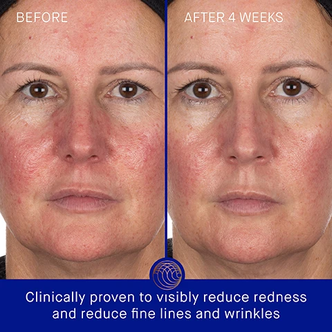 Image 3 - A split image showing the face of a person before and after using a skincare product, with the left side labeled BEFORE showing redness and skin texture issues, and the right side labeled AFTER 4 WEEKS displaying smoother skin; at the bottom, the text reads Clinically proven to visibly reduce redness and reduce fine lines and wrinkles.
              Image 4 - Image shows a close-up of a facial mask and a package on a light surface, with text detailing clinically proven results: Skin hydration improved by 95%, skin luminosity improved by 42%, and crows feet fine lines reduced by 17%.
              Image 5 - A close-up image of a person applying a golden facial treatment, with text stating user proven results: 90% agree skin texture looks and feels smoother, 92% agree skin feels instantly hydrated, and 78% agree skin appears firmed and lifted, along with a note about a consumer perception study.
              Image 6 - Image of a skin care mask shaped like a face, with four areas labeled: TFC8® - A proprietary technology that creates the optimal environment for skin cellular renewal, Acetylated Hyaluronic Acid - Deeply hydrates and plumps, Copper Peptide - Helps support natural collagen production, firming and plumping skin, and Fermented Polysaccharide - Illuminates and helps reduce appearance of fine lines and wrinkles.
              Image 7 - Image shows two steps for applying a facial mask, with a model applying an orange-gold mask and instructions: Step 1 Apply the mask to your face, starting with the top half and then the bottom. Leave on for 20 minutes. Step 2 Remove and pat in excess serum before following with your Augustinus Bader skincare routine. AB Insider Tip Use at least 2-3 times per week. Put in the fridge before use for extra cooling and de-puffing benefit.