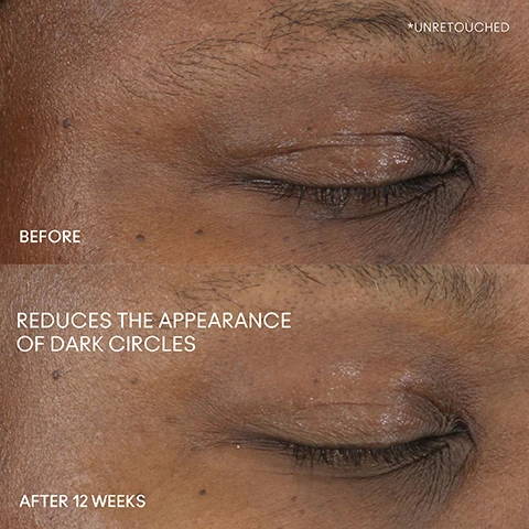 Image 1 - Before and after images showing the reduction of dark circles under the eyes, with the top image labeled as BEFORE and the bottom image stating REDUCES THE APPEARANCE OF DARK CIRCLES and AFTER 12 WEEKS.
              Image 2 - Four close-up images of diverse individuals eyes demonstrate various areas to apply a skincare product, labeled as under eyes, outer corners, inner corners, and all over lids, with a product bottle of MAC Hyper Real Serumizer Eye in the bottom right corner.
              Image 3 - Image features two cosmetic products: a small golden bottle labeled MAC Hyper Real Serumizer Eye and a black tube labeled Studio Radiance with visible text stating Instantly: Conceals Hydrates Brightens and After 12 weeks: Visible reduction in 360º dark circles along with a circular badge indicating 80% skincare ingredients.