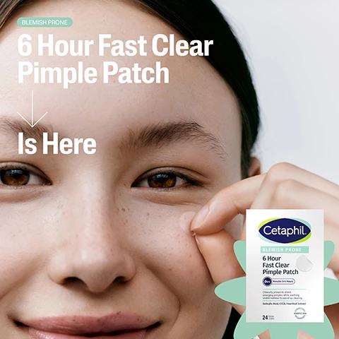 Image 1 - A close-up of a young woman with a natural look, smiling and touching her cheek, alongside a product package for Cetaphils 6 Hour Fast Clear Pimple Patch, with text that reads BLEMISH PRONE 6 Hour Fast Clear Pimple Patch Is Here.
              Image 2 - A box of Cetaphil Fast Clear Pimple Patch is shown, featuring text that reads Fights Emerging Pimples In Only 6 Hours and includes details about ingredients: Salicylic Acid, CICA, and Heartleaf, along with a total of 24 patches in the package.
              Image 3 - A young man with dark skin is applying a pimple patch to his cheek, while the image highlights the text Clinically Proven To Target Emerging Pimples and displays a product box for Cetaphil 6 Hour Fast Clear Pimple Patch with the note Recommended by Dermatologists.
              Image 4 - Image shows two close-up views of a persons skin with early-stage pimples, with the text Your Pre-Pimple Pimple Patch displayed above, and visible text stating Targets Early-Stage Spots and Not Intended For Whiteheads.
              Image 5 - A person holds a Cetaphil 6 Hour Fast Clear Pimple Patch package with visible text stating Clinically Proven To Fight Emerging Pimples and In Only 6hrs.
              Image 6 - A close-up of a person’s face showing a hand near their cheek with visible blue eyes, alongside graphics indicating ingredients for a blemish treatment, including Salicylic Acid, CICA, and Heartleaf, with a product image of Cetaphils 6 Hour Fast Clear Pimple Patch that reads Cetaphil 6 Hour Fast Clear Pimple Patch.
              Image 7 - An assortment of items is displayed on a flat surface, including sunglasses, a pen, a silver tube, and a box of Cetaphil Blemish Prone 6 Hour Fast Clear Pimple Patch, with the words Target Emerging Pimples On-The-Go.
              Image 8 - A persons hand reaching into the back pocket of jeans to retrieve a box of Cetaphil clear pimple patches, with the text On-The-Go Results. In Only 6 hrs. visible on the image.
              Image 9 - A woman with a natural look is applying a pimple patch on her cheek while smiling gently; the image also features a box of Cetaphil 6 Hour Fast Clear Pimple Patch next to her, with visible text reading Fast Rescue Pimple Patch and Blemish Prone.