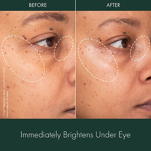 Image 1 - Side-by-side comparison of a persons under-eye area showing before and after results, with the left side labeled Before and the right side labeled After, and the text below stating Immediately Brightens Under Eye.
              Image 2 - Image showing a split view of a persons face labeled BEFORE on the left with visible dark circles under the eye, and AFTER on the right with less visible dark circles; visible text states 94% agree dark circles are less visible.
              Image 3 - Before and after images showing the eyes of a woman, with the top section labeled Before and the bottom section labeled After 4 Weeks, along with text stating 94% agree dark circles are less visible and a note about an independent study using the eye cream twice a day for 8 weeks.
              Image 4 - Image comparing the appearance of a persons under-eye area before and after treatment, with the left side labeled BEFORE showing pronounced dark circles, and the right side labeled AFTER showing improved brightness and reduced dark circles; the text at the bottom states 94% agree dark circles are less visible.
              Image 5 - A close-up of a brightening eye cream bottle on a soft background with an orange slice, featuring the text CLINICALLY PROVEN RESULTS Immediately brightens under eye After 4 Weeks: 94% agree dark circles are less visible 94% showed visible reduction in under eye lines -29% reduction in under eye lines at the top and bottom.