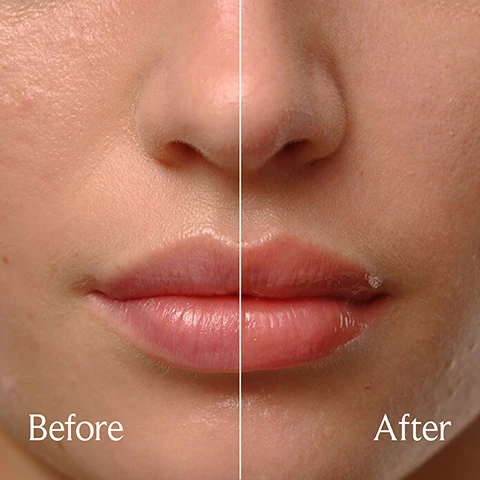 Image 1 - Image shows a close-up of a persons face split in half, with one side labeled Before showing a matte appearance and the other side labeled After displaying fuller, glossier lips.
              Image 2 - Three lip treatments are stacked, featuring a blue cap and a label that reads fresh on each; next to them is a plum and red currant, with accompanying text stating Sugar delivers hydration, Squalane restores and replenishes moisture, and Plum seed, black currant & grapeseed oils maintain hydration.
              Image 3 - A close-up image shows a red lip product being squeezed from a tube and a brush applicator dripping with red lip oil, with the text Sweeten your stack above and the product names SUGAR ROSÉ and SUGAR LIP OIL ROSÉ at the bottom.