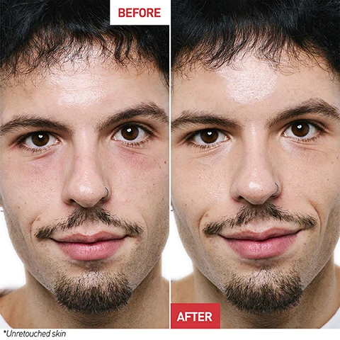 Image 1 - Image shows a side-by-side comparison of a mans face labeled BEFORE on the left and AFTER on the right, with visible improvements in skin tone and texture, and the note *Untouched skin at the bottom left.
              Image 2 - A glass dropper bottle of Erborian Korean serum stands against a soft, pastel cloud background, with text highlighting seven benefits: skin texture, uniformity of skin tone, brightness, fine lines and wrinkles, plumped appearance, nutrition, and suppleness.
              Image 3 - An orange serum bottle labeled Erborian is shown against a soft pastel background, with text highlighting its key ingredients: red pepper, allantoin, hyaluronic acid, yuzu, and centella asiatica, along with the text Ultra-concentrated Korean serum formulated with 17 super ingredients including and + 10% PHA refines skin texture.
              Image 4 - A person with long black hair holds a small bottle of Erborian skin therapy in front of their face against a soft pink and orange background, with text stating that after 1 night, 97% said their skin texture was soother, and after 28 nights, 87% said the product gave them more confidence in their skin.
              Image 5 - Image shows two skincare serums labeled Skin Therapy Milky-Serum with milky texture for combination to oily skin, and Skin Therapy Oil-Serum with oil texture for normal to dry skin, with text stating Same benefits, same effectiveness, different textures and highlighting 7 benefits and 17 super ingredients.