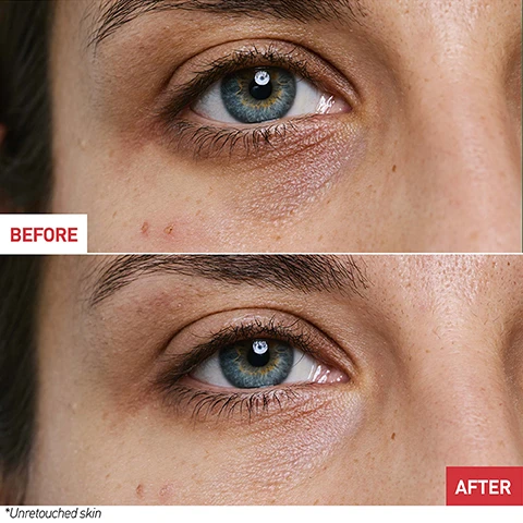 Image 1 - A close-up comparison of an eye showing the skin around it before and after treatment, with the word BEFORE in red at the top and AFTER in white on a red background at the bottom, and an asterisk note stating *Unretouched skin.
              Image 2 - Image shows three cosmetic product bottles against a soft pink cloud background, labeled as follows: skin therapy, ultra-concentrated nightcare effective from the 1st night, SKIN THERAPY EYE balm texture, SKIN THERAPY OIL-SERUM oil texture, and SKIN THERAPY MILKY-SERUM milky texture.