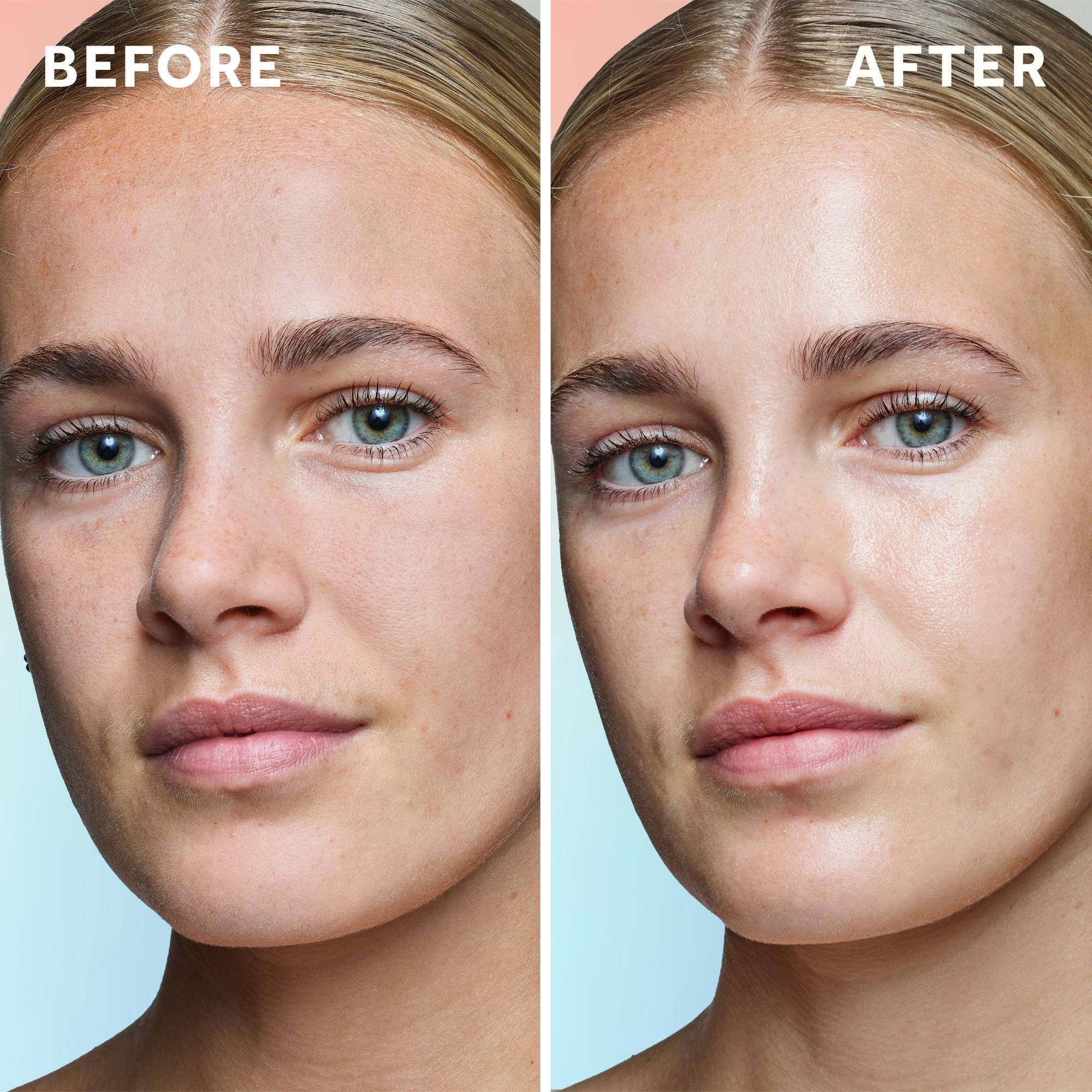 Before, After.