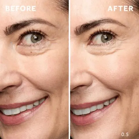 Before, After.
