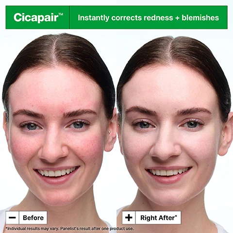 Image 1 - Image shows a side-by-side comparison of a womans face before and after using a skin treatment, with noticeable reduction in redness and blemishes; visible text includes Cicapair, Instantly corrects redness + blemishes, Before, Right After, and a note stating Individual results may vary.
              Image 2 - Image of a jar of Dr. Jart+ Cicapair Soothing Color Correcting Treatment on a swirl background, with visible text highlighting its upgraded formula that neutralises redness, along with benefits such as barrier care, mineral sunscreen SPF 30, and easy to blend texture.
              Image 3 - A woman with long dark hair is smiling and holding a green jar of Dr.Jart+ Cicapair Soothing Color Correcting Treatment, with a colorful pixelated background and the text 96% agreed it instantly corrects visible redness* next to her.
              Image 4 - A green background features two jars of Dr. Jart+ Cicapair Color Correcting Treatment, labeled with the ingredients: Centella Asiatica Extracts reduces visible redness, Allantoin strengthens skin’s barrier, R-Protector soothes, and Zinc Oxide protects with mineral SPF.
              Image 5 - A smiling woman with long brown hair is applying a green cream to her cheek while holding a jar labeled Dr.Jart+ Cicapair Soothing Color Correcting Treatment with a pastel pink and green geometric background, featuring text that reads Instantly conceals blemishes, Non-acnegenic, and Non-comedogenic.
              Image 6 - Image shows a jar of Dr. Jart+ Cicapair Soothing Color Correcting Treatment with a light green cream inside, placed against a pink background, featuring visible text that reads +Dermatologist tested +Suitable for Rosacea and Sensitive Skin and includes the National Rosacea Society logo with the word ACCEPTED.