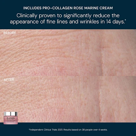 Image 5 - Close-up image displaying a before and after comparison of skin texture, showing a BEFORE section with more prominent fine lines and wrinkles and an AFTER section with smoother skin, with a pink jar of Elemis Pro-Collagen Rose Marine Cream Hydrating day cream in the bottom left, and text across the top stating INCLUDES PRO-COLLAGEN ROSE MARINE CREAM, Clinically proven to significantly reduce the appearance of fine lines and wrinkles in 14 days.*, followed by a disclaimer at the bottom reading *Independent Clinical Trials 2021. Results based on 38 people over 4 weeks. Image 6 - The image displays two open pink jars of Elemis skincare products on a blue background: on the left, a larger jar of yellow balm with accompanying text PRO-COLLAGEN ROSE CLEANSING BALM Clinically proven to remove long-wear & waterproof makeup*, and the jar labeled ELEMIS PRO-COLLAGEN ROSE CLEANSING BALM Hydrating cleansing balm; on the right, a smaller jar of white cream with accompanying text PRO-COLLAGEN ROSE MARINE CREAM Clinically proven to significantly reduce the appearance of fine lines and wrinkles in 14 days**, and the jar labeled ELEMIS PRO-COLLAGEN ROSE MARINE CREAM Hydrating day cream; footnotes at the bottom state *Independent Clinical Trial 2025. and **Independent Clinical Trials 2021. Results based on 38 people over 4 weeks. Image 7 - A two-step Elemis skincare routine is displayed on a dark background, showing a larger pink jar on the left labeled Step 1 Cleanser, Elemis Pro-Collagen Rose Cleansing Balm Hydrating cleansing balm, and Cleanse & Nourish, alongside a smaller pink jar on the right labeled Hydrate & Firm, Elemis Pro-Collagen Rose Marine Cream Hydrating day cream, and Step 2 Moisturiser.