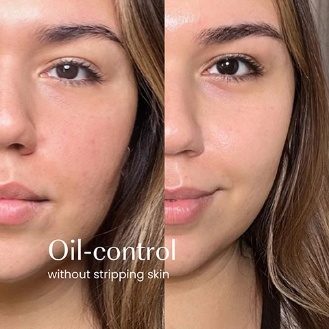 Image 1 - Close-up split image of a womans face showing a before and after skin comparison, with the left side appearing slightly shiny with more visible pores and the right side looking smoother and more matte, with the text Oil-control without stripping skin. Image 2 - A skincare product shot features a teal izil Green Tea Oil Control Gel Cleanser tube, a halved papaya with seeds, and a small glass jar filled with green tea leaves, all arranged on light-colored stone blocks against a beige background, with visible text reading: izil GREEN TEA OIL CONTROL GEL CLEANSER REDUCE EXCESS OIL, BRIGHTEN & GENTLY EXFOLIATE Papaya Enzymes, Matcha, Zinc PCA GEL NETTOYANT SÉBO-RÉGULATEUR AU THÉ VERT RÉDUIT LEXCÈS DE SÉBUM, ÉCLAIRCIT ET EXFOLIE DOUCEMENT NORMAL, COMBO & OILY SKINS جل منظف و منظم للدهون بالشاي الأخضر يقلل من دهون البشرة الزائدة و يفتحها و يقشرها بلطف PAPAYA ENZYMES ZINC PCA MATCHA. Image 3 - A hand with light pink manicured nails holds a dark green tube of Izil Green Tea Oil Control Gel Cleanser, with text on the left reading Removes excess oil, Brightens, Balances, and text on the tube reading Izil Green Tea Oil Control Gel Cleanser Reduce excess oil brighten & gently exfoliate Papaya Enzymes, Matcha, Zinc PCA Gel Nettoyant Sero-Regulateur au The Vert غسول الشاي الأخضر المنظف و المنقي للبشرة Normal, Combo & Oily Skin Types. Image 4 - A close-up of a viscous, yellowish gel with tiny particles and bubbles shows the text 98.6% NATURAL MICROPLASTICS-FREE CRUELTY-FREE FREE FROM GMOS, ALCOHOL & SULPHATES. Image 5 - A collection of five Izil Green Tea skincare products are displayed on stacked light-colored rocks with dried green tea leaves in two small beakers, a cut papaya half, and a warm brown background, with text labels reading Clarify pointing to izil GREEN TEA OIL CONTROL GEL CLEANSER REDUCE EXCESS OIL BRIGHTEN & GENTLY EXFOLIATE Papaya Enzymes, Witch Hazel, Zinc PCA NORMAL, COMBO & OILY SKIN CONTAINS 95.8% NATURALLY DERIVED INGREDIENTS, Balance pointing to izil GREEN TEA & SALICYLIC PORE-CLARIFYING TONER REDUCE OIL DEEP CLEAN PORES & BRIGHTEN Salicylic Acid, Green Tea, Aloe Vera NORMAL, COMBO & OILY SKIN, Detoxify pointing to izil PURE REGENERATING PRICKLY PEAR OIL 5 100% PURE & ORGANIC UNREFINED COLD PRESSED izil, Renew pointing to izil GREEN TEA PORE PERFECTING CREAM GREEN TEA & ALOE VERA REDUCES PORES & BRIGHTENS NORMAL, COMBO & OILY SKIN, and Exfoliate pointing to izil GREEN TEA BALANCING & BRIGHTENING SCRUB EXFOLIATE BRIGHTEN & NOURISH Argan Oil, Aloe Vera, Apricot NORMAL, COMBO & OILY SKIN. Image 6 - The image displays two dark teal tubes of izil Green Tea Oil Control Gel Cleanser side-by-side, the left tube showing the old design and the right tube the new design, with accompanying text New Look, Same formula you love, and on both tubes izil Green Tea Oil Control Gel Cleanser, Reduce excess oil, Brighten & gently exfoliate, GEL NETTOYANT SEBO-REGULATEUR AU THE VERT, Normal-Oily.