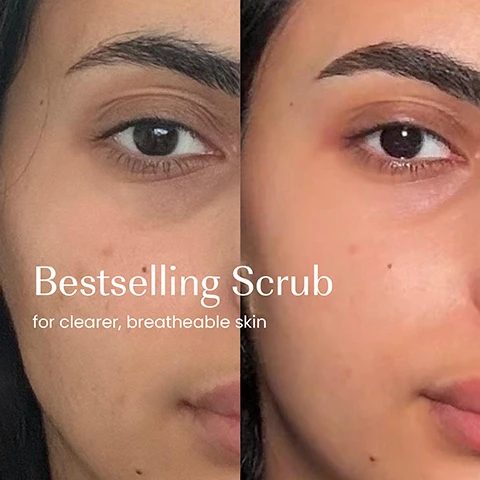 Image 1 - A split image showing a womans face before and after a scrub, with the left side showing less clear skin and the right side showing smoother, more radiant skin, with the text Bestselling Scrub for clearer, breathable skin. Image 2 - A dark teal tube of IZIL Green Tea Balancing & Brightening Scrub is displayed with an aloe vera leaf, a small jar of green tea leaves, and apricots on stone blocks against a beige background, with overlaid text reading ALOE VERA, ARGAN OIL, and APRICOT OIL, and the product tube text reading izil, GREEN TEA BALANCING & BRIGHTENING SCRUB, EXFOLIATE, BRIGHTEN & NOURISH, Argan Oil. Aloe Vera. Apricot Oil, GOMMAGE ÉQUILIBRANT ET ÉCLAIRCISSANT AU THÉ VERT, NORMAL, COMBO & OILY SKIN TYPES. Image 3 - A persons hands hold a dark teal tube of Izil Green Tea Balancing & Brightening Scrub, with text on the left stating Removes blackheads, Removes excess oil, Brightens, and the tube itself reads Izil, Green Tea Balancing & Brightening Scrub, Exfoliate, Brighten & Nourish, Argan Oil, Aloe Vera, Apricot Oil, Gommage Équilibrant et Éclaircissant au Thé Vert, مقشر موازن ومفتح بالشاى الأخضر, Normal, Combo & Oily Skin Types. Image 4 - A dark, textured surface serves as a background for the white text that reads: 96.4% NATURAL, HALAL, MICROPLASTICS-FREE, CRUELTY-FREE, FREE FROM GMOS, ALCOHOL & ARTIFICIAL COLOURS. Image 5 - A vibrant studio image showcases five izil skincare products arranged on natural stone slabs with a papaya slice and loose green tea leaves, associated with the functions Clarify, Balance, Detoxify, Renew, and Exfoliate; visible text on products includes: izil GREEN TEA OIL CONTROL GEL CLEANSER REDUCE EXCESS OIL BRIGHTEN & GENTLY EXFOLIATE Papaya Enzymes Witch Hazel Zinc PCA NORMAL OILY & COMBINATION SKIN 100% NATURAL & SAFE MADE IN MOROCCO; izil GREEN TEA & SALICYLIC PORE-CLARIFYING TONER REDUCE OIL DEEP CLEAR PORES & BRIGHTEN Witch Hazel Salicylic Acid Green Tea Extract NORMAL OILY & COMBINATION SKIN 100% NATURAL & SAFE MADE IN MOROCCO; izil PURE REGENERATING PRICKLY PEAR OIL ANTI-AGING REVITALIZING & BRIGHTENING Argan Oil Green Tea Vitamin E NORMAL OILY & COMBINATION SKIN 100% NATURAL & SAFE MADE IN MOROCCO; izil GREEN TEA PORE REFINING CREAM REDUCE PORES BRIGHTEN & HYDRATE Green Tea Extract White Clay Hyaluronic Acid NORMAL OILY & COMBINATION SKIN 100% NATURAL & SAFE MADE IN MOROCCO; izil GREEN TEA BALANCING & BRIGHTENING SCRUB EXFOLIATE & NOURISH Argan Oil Aloe Vera Apricot Oil NORMAL OILY & COMBINATION SKIN 100% NATURAL & SAFE MADE IN MOROCCO. Image 6 - An image showing a product packaging redesign for a beauty scrub, with the old dark brown bottle on the left and the new dark teal tube on the right, and overhead text that reads New Look, Same formula you love; the old bottle displays izil, 1 BRIGHTEN, GREEN TEA, BRIGHTENING SCRUB, while the new tube displays izil, GREEN TEA BALANCING & BRIGHTENING SCRUB, EXFOLIATE, BRIGHTEN & NOURISH, Argan Oil - Aloe Vera - Apricot Oil, Normal, Oily & Dull Skin.