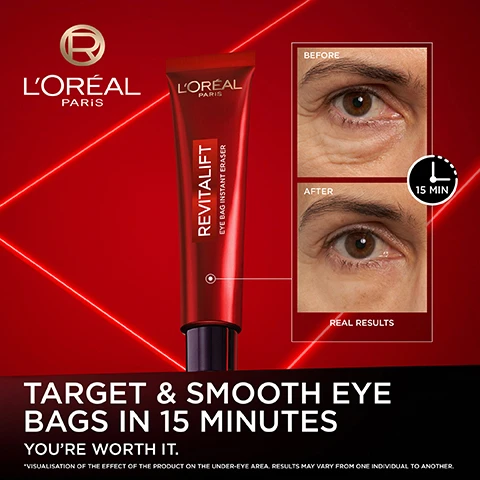 Image 2 - A LOréal Paris advertisement displays a red tube of Revitalift Eye Bag Instant Eraser alongside before and after close-up images of an eye, showing a reduction in under-eye bags in 15 minutes, with visible text including LOréal Paris, Revitalift Eye Bag Instant Eraser, Before, After, 15 Min, Real Results, Target & Smooth Eye Bags in 15 Minutes, Youre Worth It, and a disclaimer *Visualisation of the effect of the product on the under-eye area. Results may vary from one individual to another. Image 3 - A hand holds a red tube of LOréal Revitalift Eye Bag Instant Eraser eye cream against a red background, with text on the left stating: IMMEDIATELY REDUCES UNDER-EYE: WRINKLES, BAGS, PUFFINESS, LACK OF FIRMNESS, CREPEY SKIN. RESULTS THAT LAST THROUGHOUT THE DAY. Image 4 - A red infographic displays GEL-TO-TAPE TECHNOLOGY with three petri dishes demonstrating its effects: TARGET CREATES AN ADHESIVE FILM ON SKIN THAT COMPRESSES BAGS, TIGHTEN ULTRA-ELASTIC FORMULA RESISTS FACIAL MOVEMENTS ALL DAY LONG, and BLUR PROVIDES A TRANSPARENT FILTER-LIKE FINISH, alongside a red tube labeled LORÉAL PARIS REVITALIFT EYE BAG INSTANT ERASER. Image 5 - The image displays usage instructions for a skincare product, featuring a red LOréal Paris Revitalift Eye Bag Instant Eraser tube, with the visible text: HOW TO USE? 1 APPLY A TINY AMOUNT TO A CLEAN FINGERTIP AND TAP GENTLY UNDER YOUR EYES, FROM INNER TO OUTER CORNER. CAN BE USED OVER SKINCARE OR MAKEUP. 2 RELAX LET THE PRODUCT WORK FOR 15 MINUTES. 3 ENJOY ALL-DAY RESULTS. REMOVE AT NIGHT WITH A WATERPROOF MAKEUP REMOVER. Image 6 - A promotional image on a red background with red laser lines displays three LOréal Revitalift Laser skincare products for an AGE-CORRECTING ROUTINE: Step 1 shows a LOréal Paris Revitalift Laser Tri-Peptides Age-Correcting Serum dropper bottle for TRI-PEPTIDE SERUM, Step 2 shows an open jar of Revitalift Laser Day cream for TRIPLE ACTION CREAM, and Step 3 shows a LOréal Paris Revitalift Eye Bag Instant Eraser tube for EYE BAG ERASER, with an R logo at the bottom right. Image 7 - The image features a grid of six close-up images of human eyes, with three before treatment panels on the top row displaying visible eye bags and wrinkles, and three corresponding after treatment panels on the bottom row showing a reduction in these concerns, accompanied by the text Clinically Proven on Severe Eye Bags & Wrinkles, Before, After, and the disclaimer *Visualisation of the effect of the product on the under-eye area. Results may vary from one individual to another. Image 8 - A dark red graphic with glowing red lines and white text displays information about LOréal Paris Skin Science, reading Trust LOréal Paris Skin Science, followed by three points: first, a microscope icon with a golden R logo and the text Independently Proven Clinical Efficacy; second, beakers with a checkmark icon and the text Tolerance Validated By More Than 600 Applications; and third, a golden R logo surrounded by No Animal Testing text, followed by LOréal has been committed to beauty without animal testing since 1989. Image 9 - A woman holds a red tube of LOréal Paris Revitalift Laser Eye Cream and looks at the camera, with text overlays reading DRAMATIC RESULTS YOU CAN SEE, 95% SAY UNDER-EYE BAGS ARE VISIBLY REDUCED *SELF ASSESSMENT, 83 WOMEN., and 94% SAY THE UNDER-EYE AREA LOOKS SMOOTHER, FIRMER, AND LIFTED.
